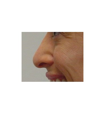 pre